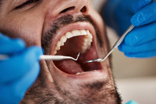 Best Emergency Dental Care for Abscessed Tooth in Cottage City, MD