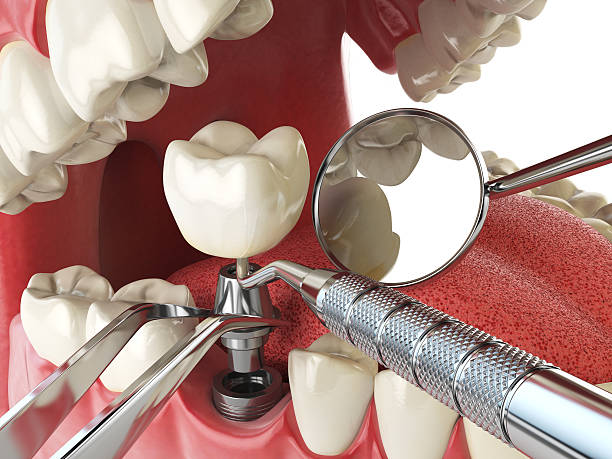 Best Emergency Dental Services for Seniors in Cottage City, MD